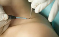 Dermatological Surgery