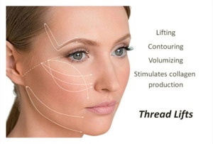 thread-lifts